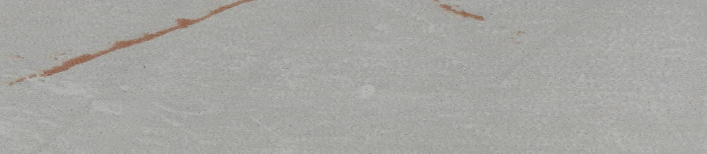 Lagina Pvc-Kenar Bandı
